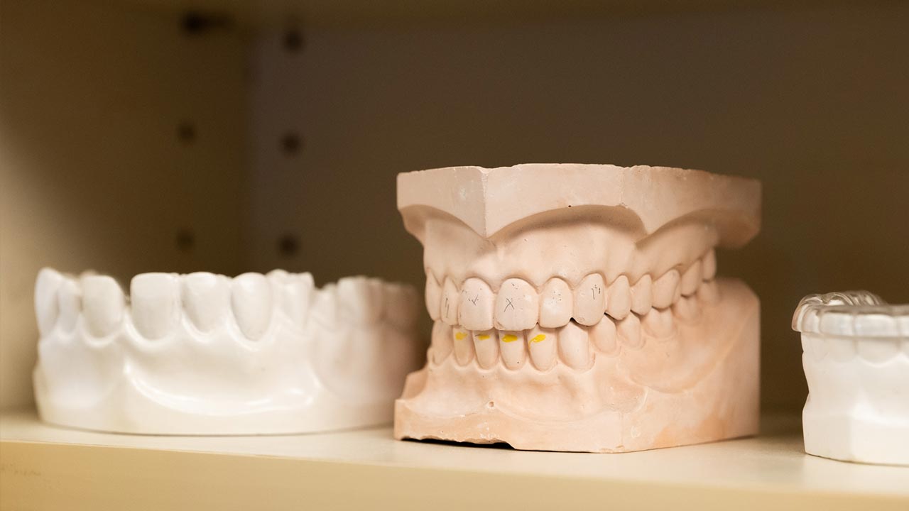 Dental Bonding